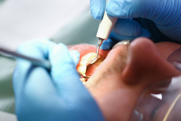 Best Emergency Broken Tooth Repair in Bound Brook, NJ
